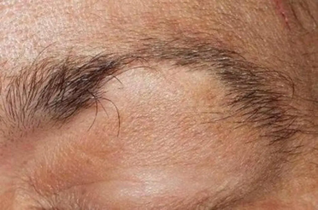 Sopracciglia con zone diradate, un dettaglio che pu&ograve; far pensare a come far ricrescere le sopracciglia.
